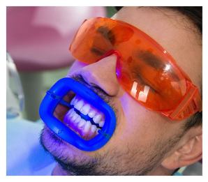 teeth whitening